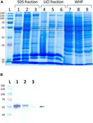 Enolase of Staphylococcus lugdunensis Is a Surface-Exposed Moonlighting Protein That Binds to Extracellular Matrix and the Plasminogen/Plasmin System